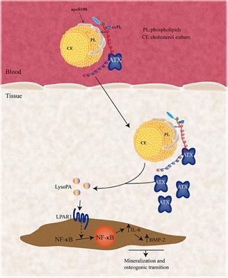 Autotaxin and Lipoprotein Metabolism in Calcific Aortic Valve Disease